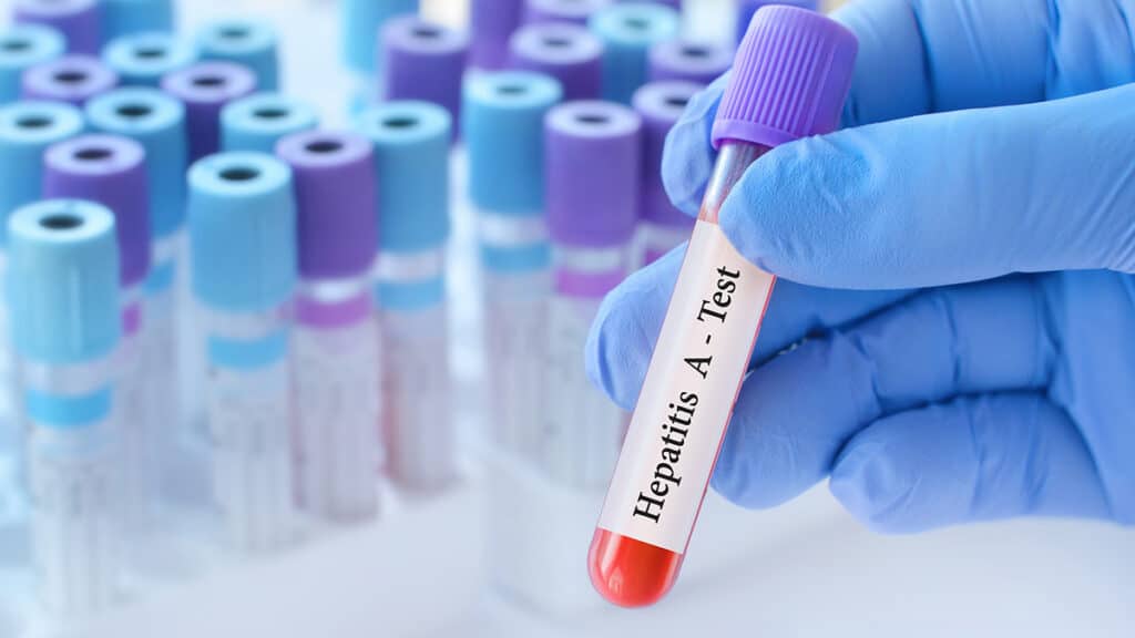 Balochistan faces alarming surge in Hepatitis cases, experts warn