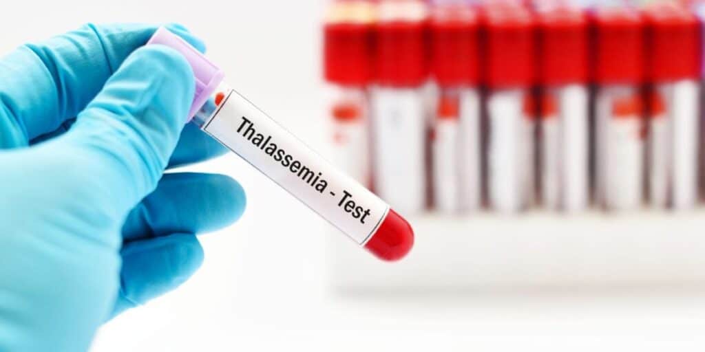 Balochistan government decides to make pre-marital Thalassemia test mandatory