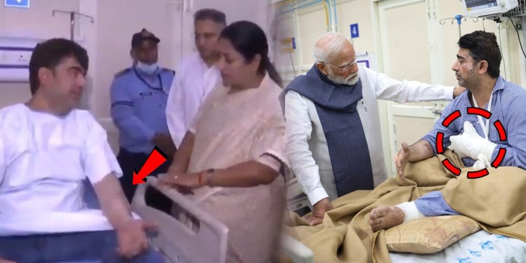 Speedy recovery of a Delhi blast-victims stuns everyone