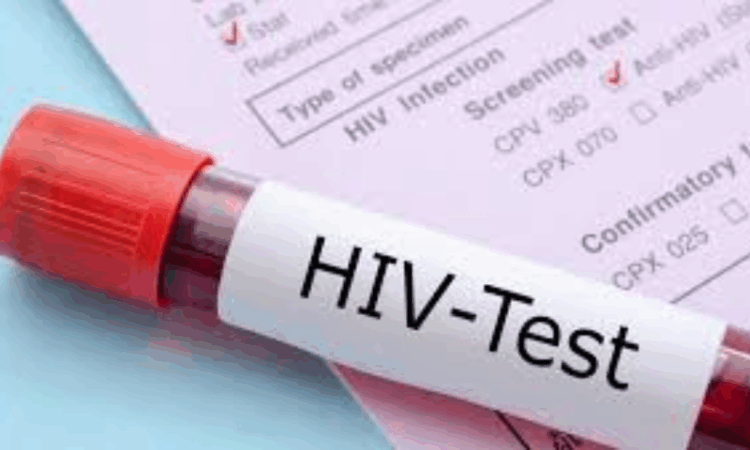 Nearly 40,000 people living with HIV in K-P, officials warn of rising daily infections