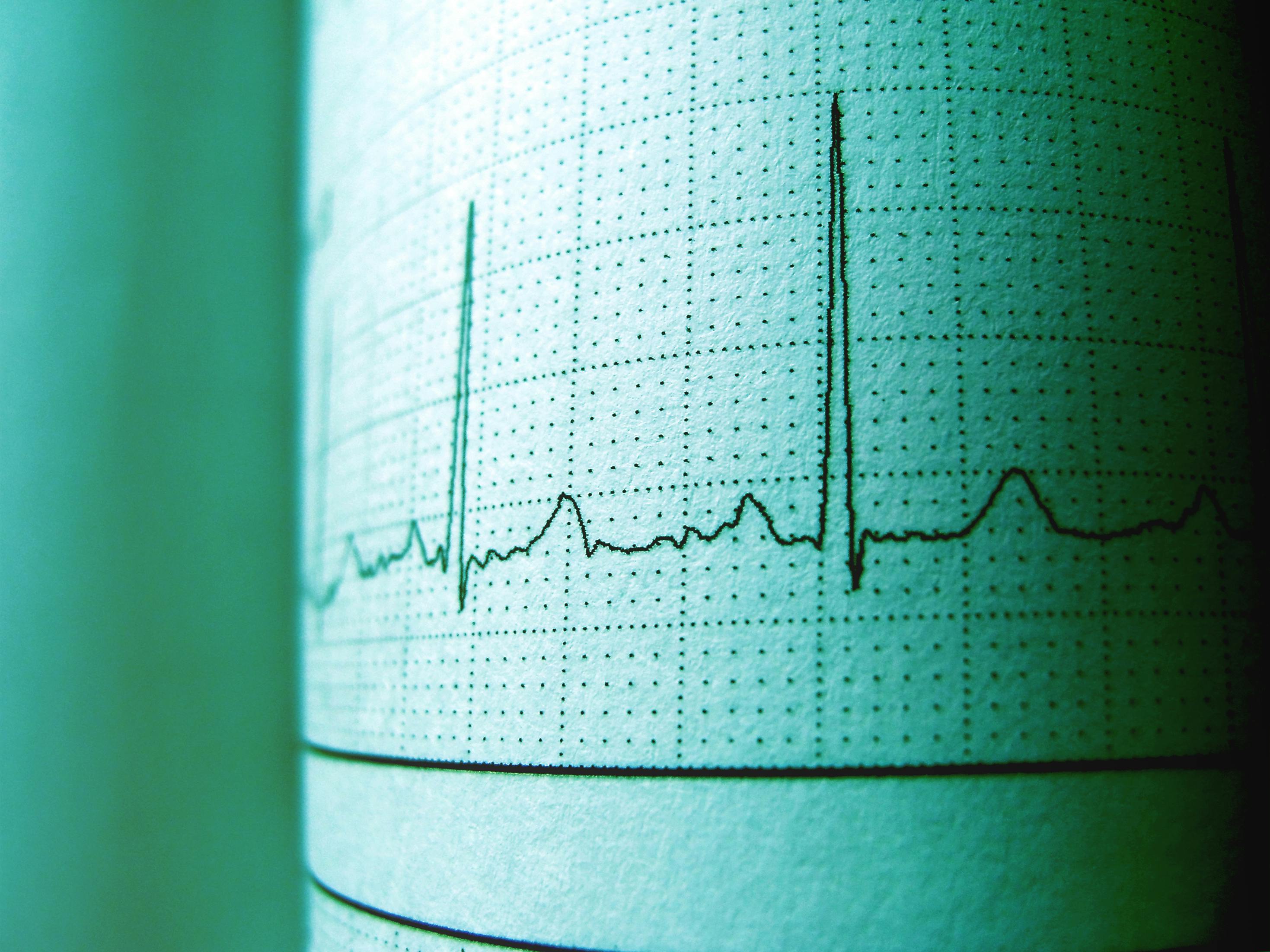 Close-up of an ECG printout displaying heartbeat rhythm and frequency for medical analysis.