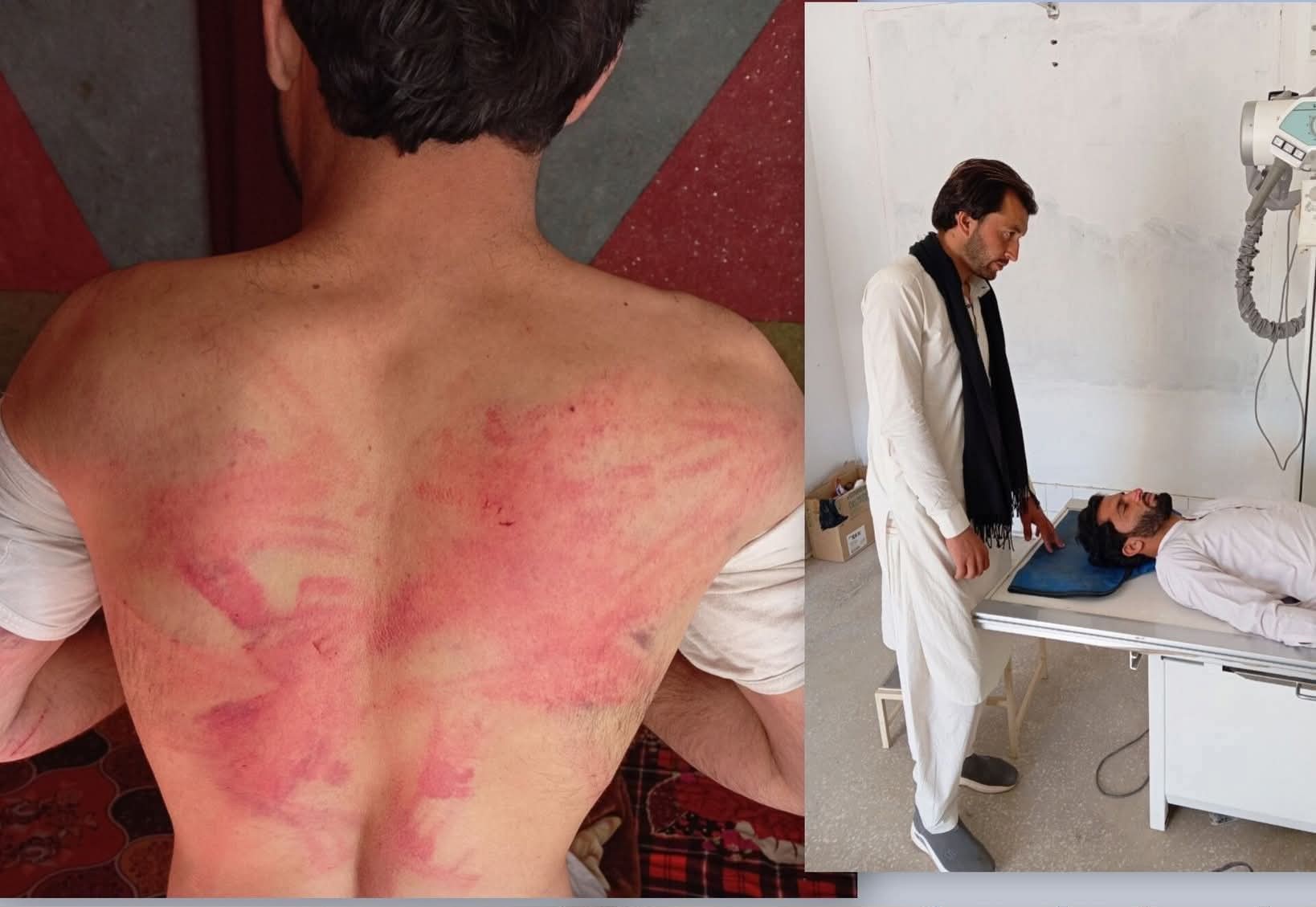 North Waziristan: Khawarij Abduct, Torture Journalist for Promoting Young Girl Cricketer’s Talent