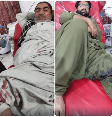 Turbat Taleemi Chowk Blast: Two Passers-by Injured