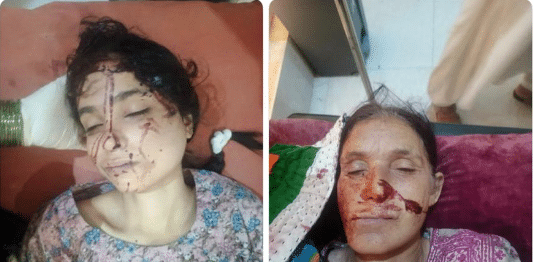 BLA dogs shot dead six women for not joining BYC