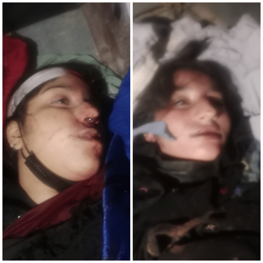Two young girls killed, parents and girl injured in attack by dogs of Fitna-ul-Hindustan in Gulistan